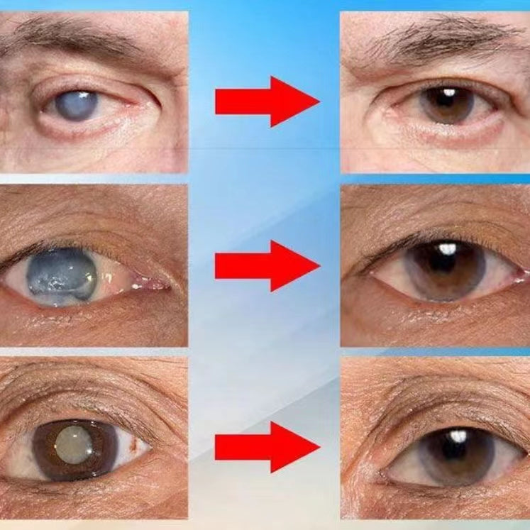 Pure natural plant extract eye drops（2PCS）